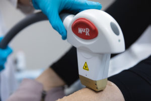 Laser hair removal at plastic surgery of michigan